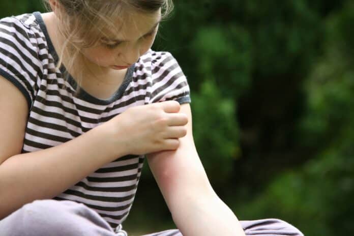 How to: reduce mosquitoes around your home – Bundaberg Now
